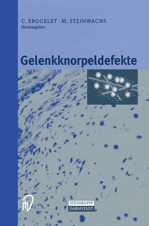 Produktbild: Gelenkknorpeldefekte