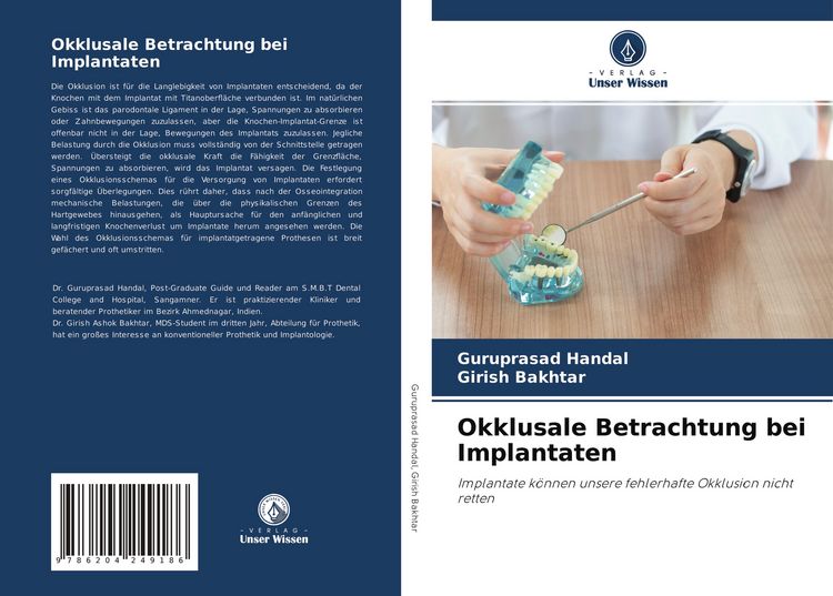 Produktbild: Okklusale Betrachtung bei Implantaten