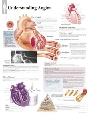 Produktbild: Understanding Angina Chart