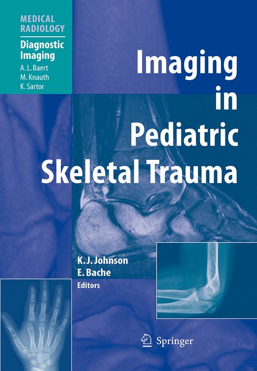 Produktbild: Imaging in Pediatric Skeletal Trauma