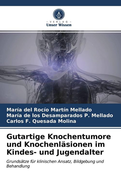 Produktbild: Gutartige Knochentumore und Knochenl&auml;sionen im Kindes- und Jugendalter