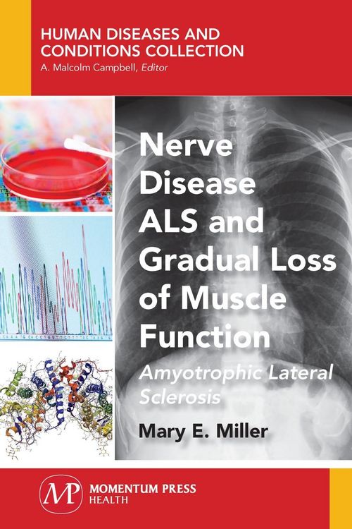 Produktbild: Nerve Disease ALS and Gradual Loss of Muscle Function
