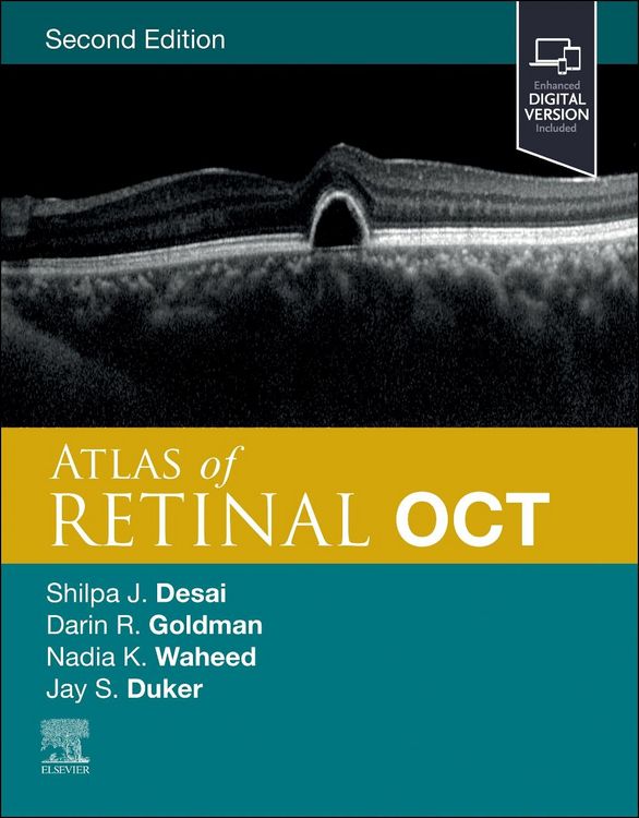 Produktbild: Atlas of Retinal OCT