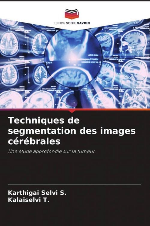Produktbild: Techniques de segmentation des images c&eacute;r&eacute;brales