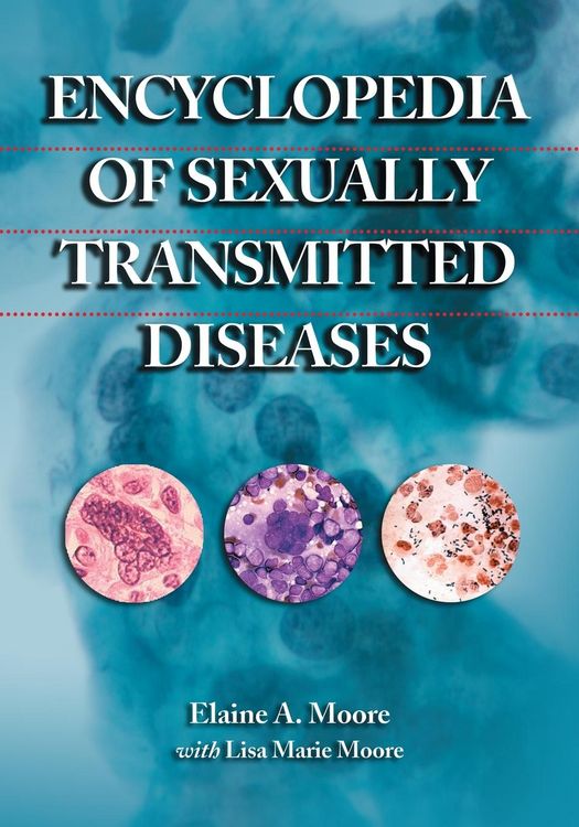 Produktbild: Encyclopedia of Sexually Transmitted Diseases