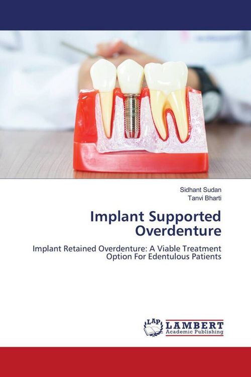 Produktbild: Implant Supported Overdenture