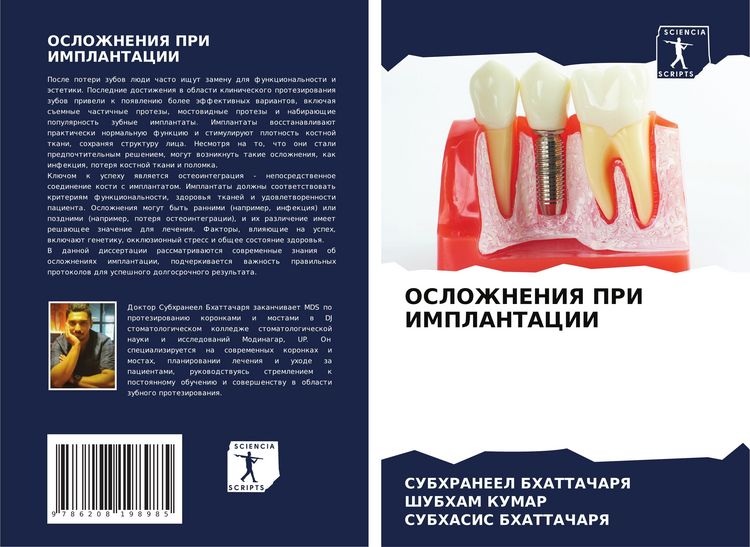Produktbild: Oslozhneniya Pri Implantacii