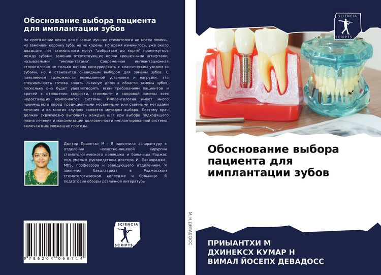 Produktbild: Obosnowanie wybora pacienta dlq implantacii zubow
