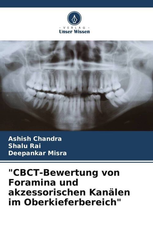Produktbild: "CBCT-Bewertung von Foramina und akzessorischen Kan&auml;len im Oberkieferbereich"