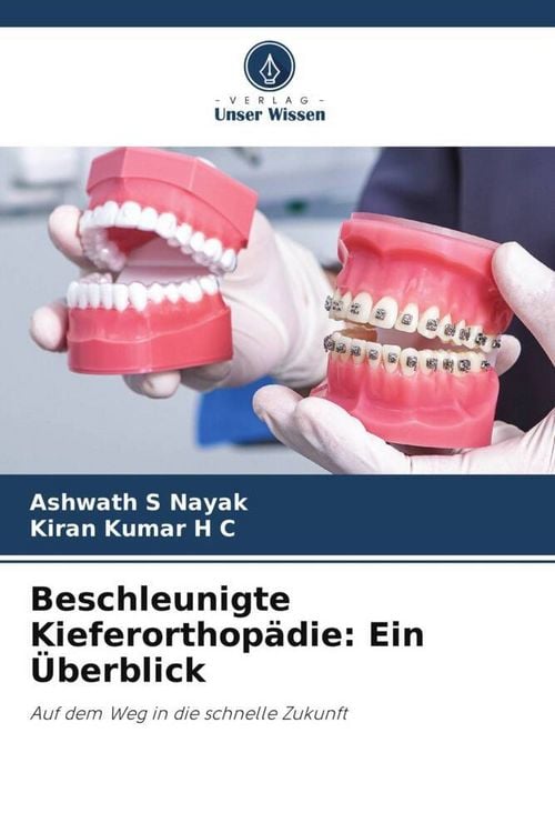 Produktbild: Beschleunigte Kieferorthop&auml;die: Ein &Uuml;berblick