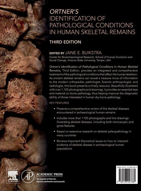 Produktbild: Ortner's Identification of Pathological Conditions in Human Skeletal Remains