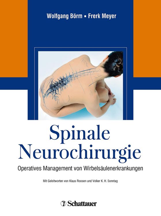Produktbild: Spinale Neurochirurgie