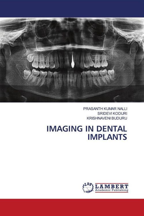 Produktbild: Imaging in Dental Implants