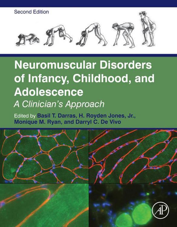 Produktbild: Neuromuscular Disorders of Infancy, Childhood, and Adolescence