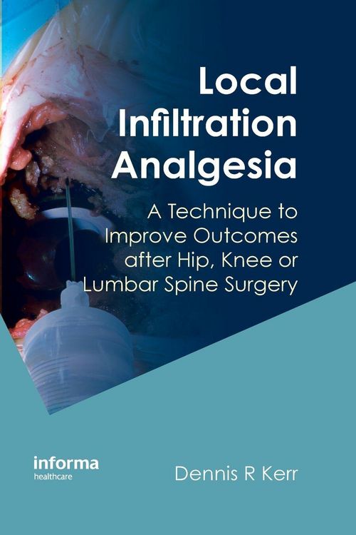 Produktbild: Local Infiltration Analgesia