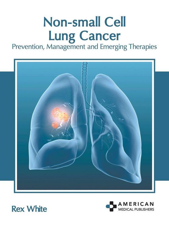 Produktbild: Non-Small Cell Lung Cancer: Prevention, Management and Emerging Therapies