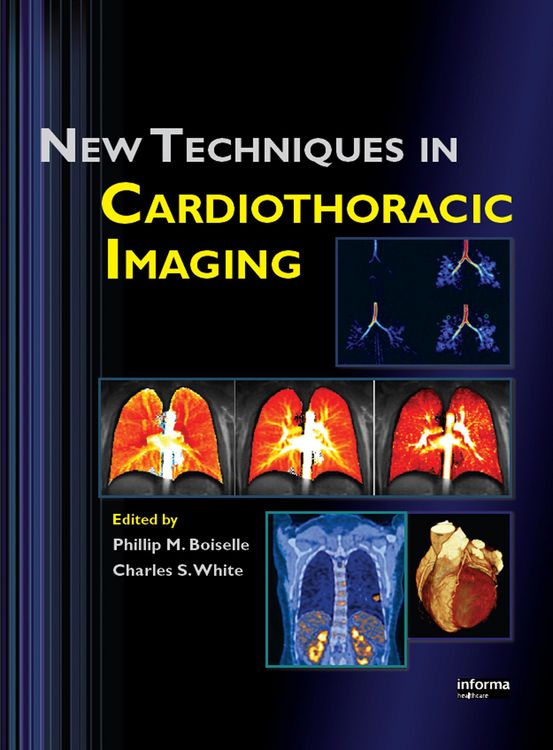 Produktbild: New Techniques in Cardiothoracic Imaging