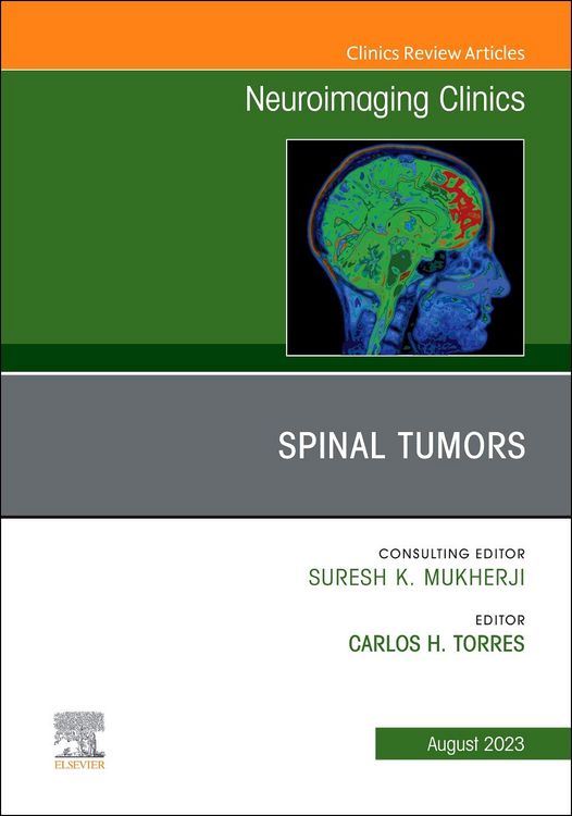 Produktbild: Spinal Tumors, an Issue of Neuroimaging Clinics of North America