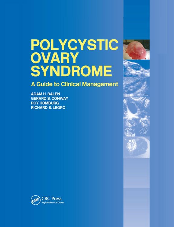 Produktbild: Polycystic Ovary Syndrome