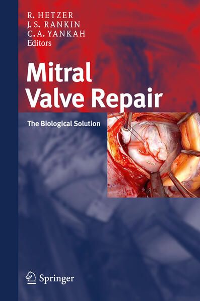 Produktbild: Mitral Valve Repair