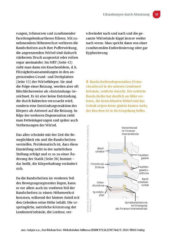 Produktbild: Der R&uuml;cken-Doc: Wirbels&auml;ulen-Arthrose