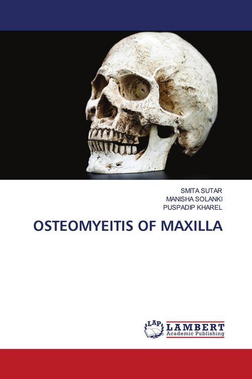 Produktbild: Osteomyeitis Of Maxilla