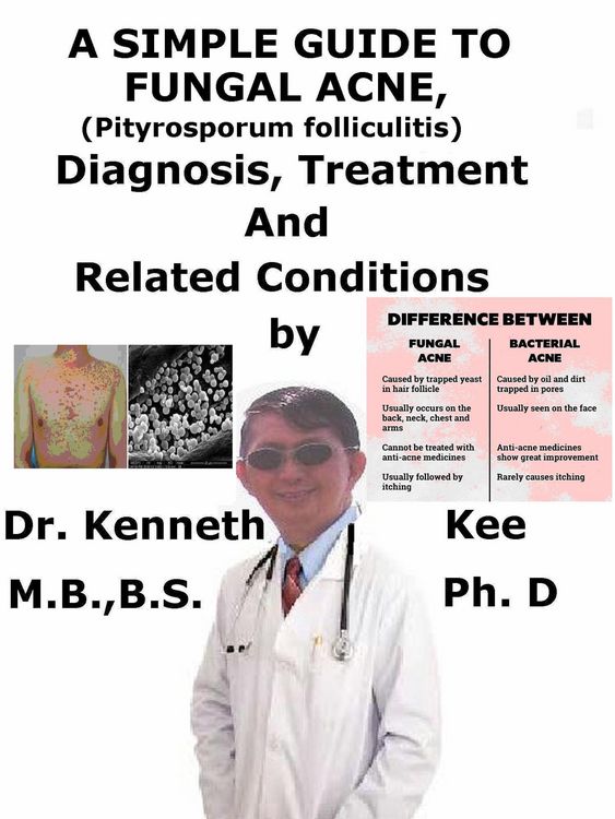 Folliculitis: How to Cure This Annoying Condition and Reclaim Your Smooth Skin