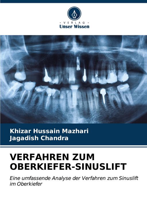 Produktbild: Verfahren Zum Oberkiefer-Sinuslift