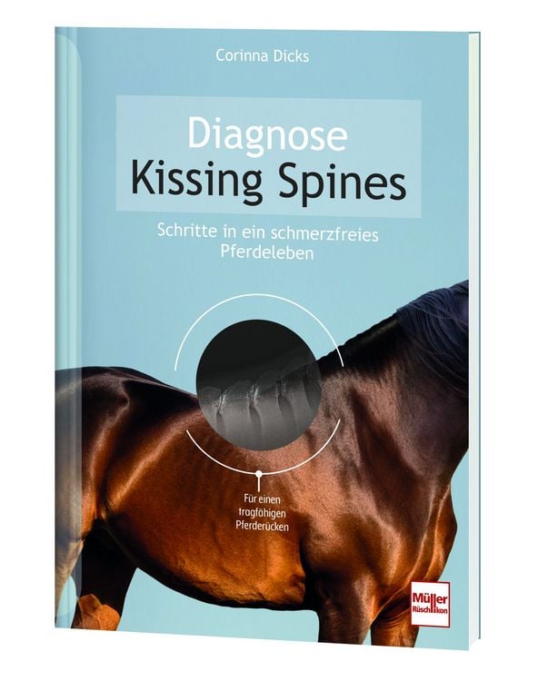 Produktbild: Diagnose Kissing Spines