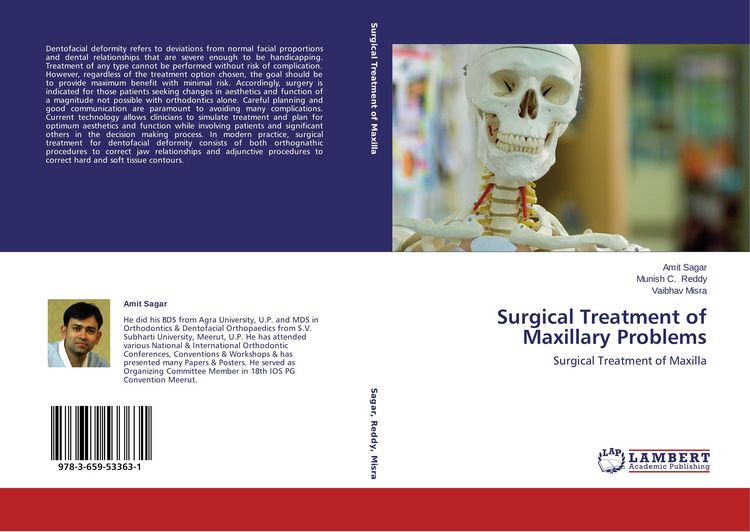 Produktbild: Surgical Treatment of Maxillary Problems