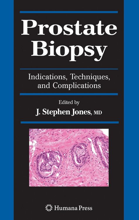 Produktbild: Prostate Biopsy