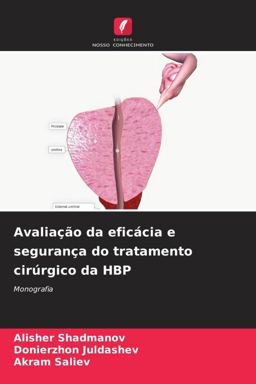 Produktbild: Avalia&ccedil;&atilde;o da efic&aacute;cia e seguran&ccedil;a do tratamento cir&uacute;rgico da HBP