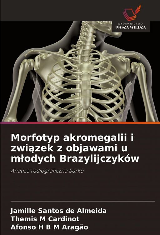 Produktbild: Morfotyp akromegalii i zwi&iquest;zek z objawami u m&iquest;odych Brazylijczyk&oacute;w