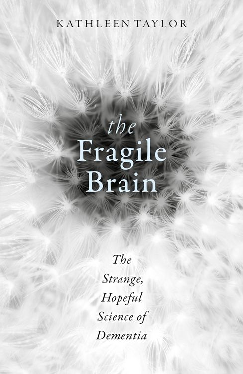 Produktbild: The Fragile Brain