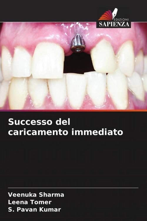 Produktbild: Successo del caricamento immediato