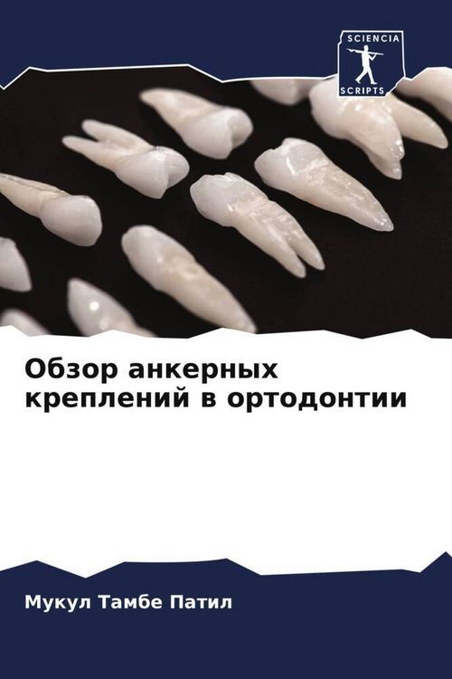 Produktbild: Obzor ankernyh kreplenij w ortodontii