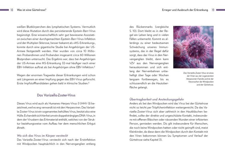 Produktbild: G&uuml;rtelrose
