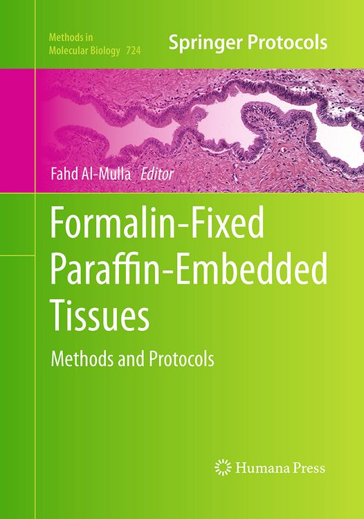 Produktbild: Formalin-Fixed Paraffin-Embedded Tissues