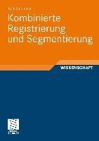 Produktbild: Kombinierte Registrierung und Segmentierung