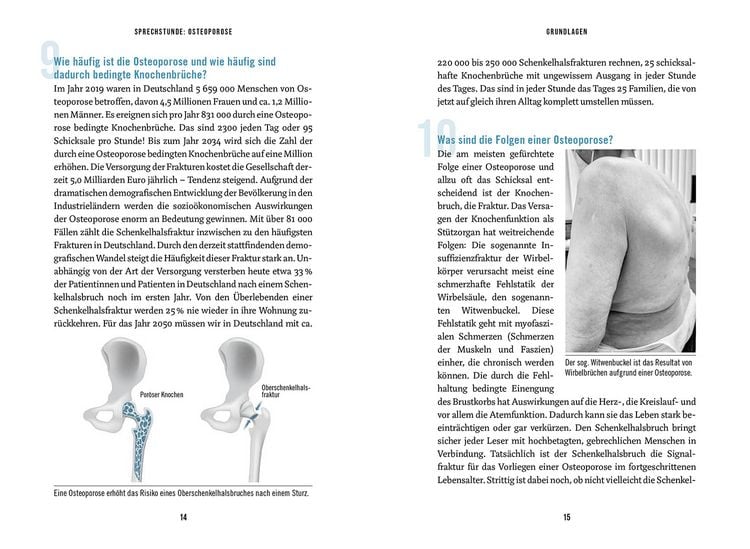 Produktbild: In der Sprechstunde: Osteoporose