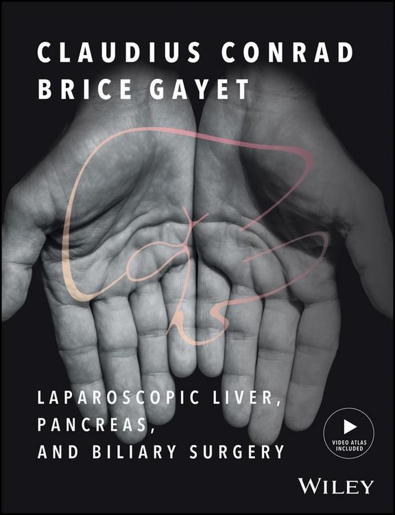 Produktbild: Laparoscopic Liver, Pancreas, and Biliary Surgery