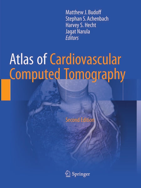 Produktbild: Atlas of Cardiovascular Computed Tomography