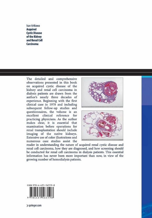 Produktbild: Acquired Cystic Disease of the Kidney and Renal Cell Carcinoma