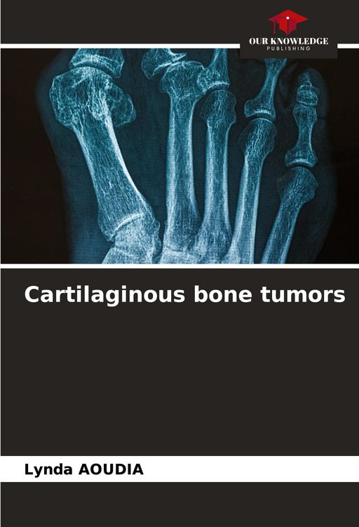 Produktbild: Cartilaginous bone tumors