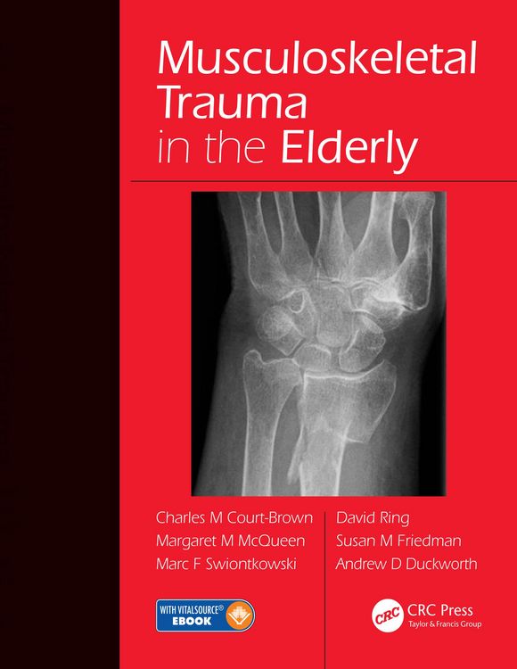 Produktbild: Musculoskeletal Trauma in the Elderly
