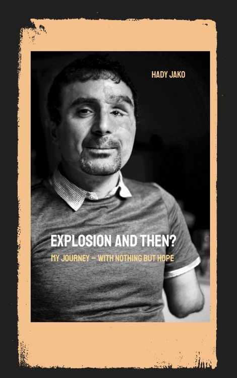 Produktbild: Explosion and then?