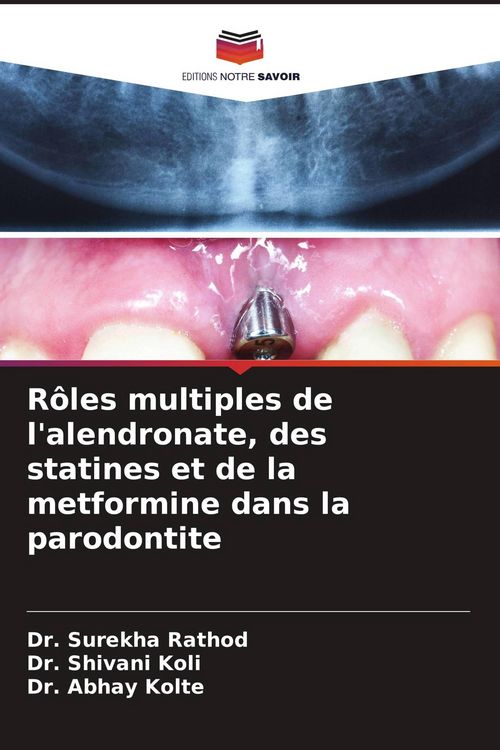 Produktbild: R&ocirc;les multiples de l'alendronate, des statines et de la metformine dans la parodontite