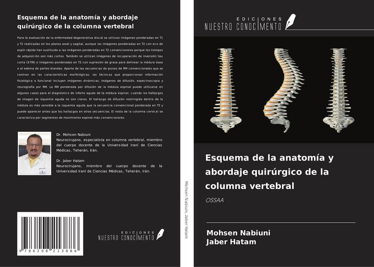Produktbild: Esquema de la anatom&iacute;a y abordaje quir&uacute;rgico de la columna vertebral