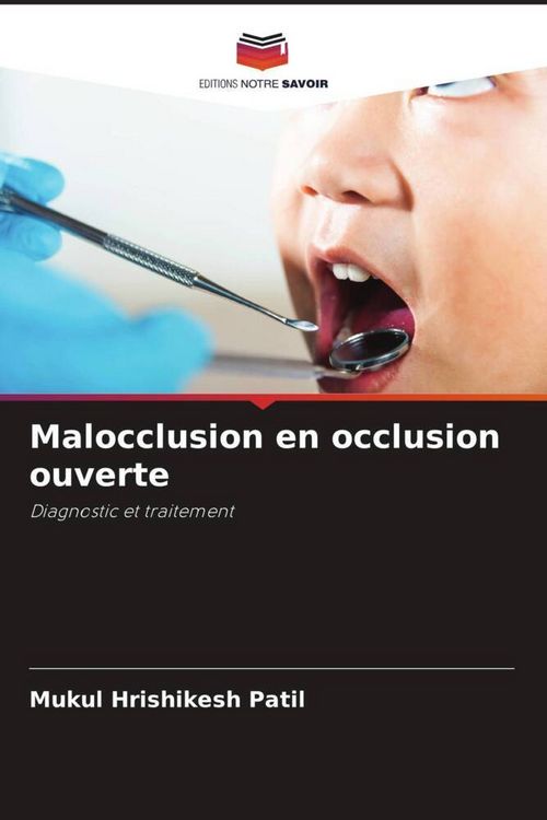 Produktbild: Malocclusion en occlusion ouverte
