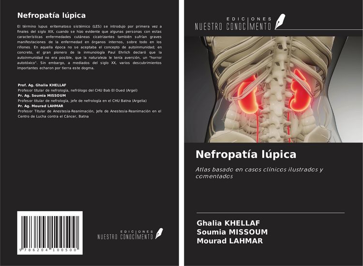 Produktbild: Nefropat&iacute;a l&uacute;pica